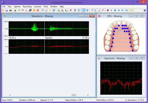 RoseMedical icSpeech Crack